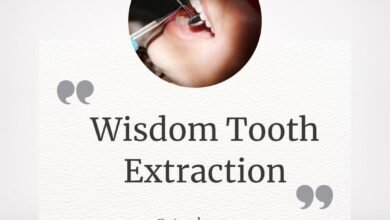 wisdom tooth extraction