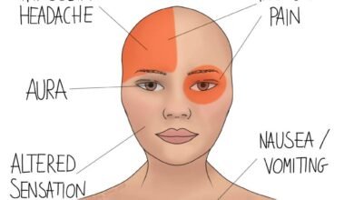 migraine stress management