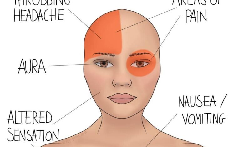 migraine stress management