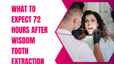 what to expect 72 hours after wisdom tooth extraction