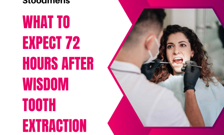 what to expect 72 hours after wisdom tooth extraction