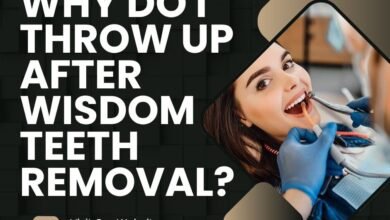 why do I throw up after wisdom teeth removal