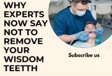 why experts now say not to remove your wisdom teeth