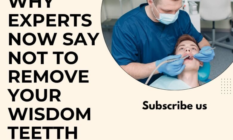 why experts now say not to remove your wisdom teeth